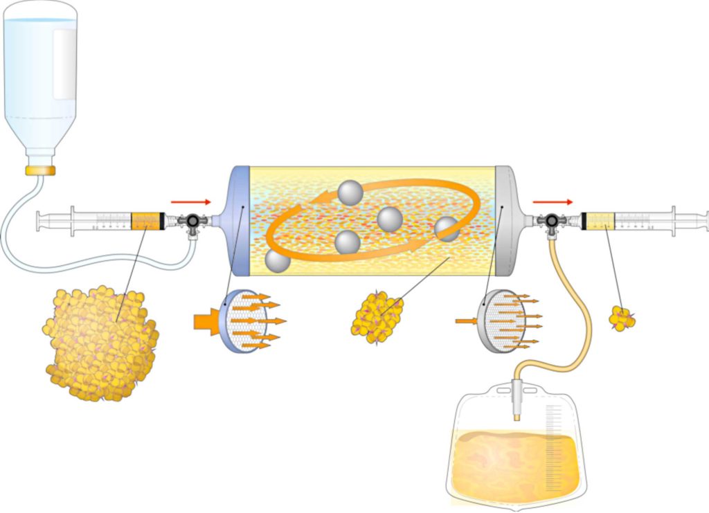 lipogems-2